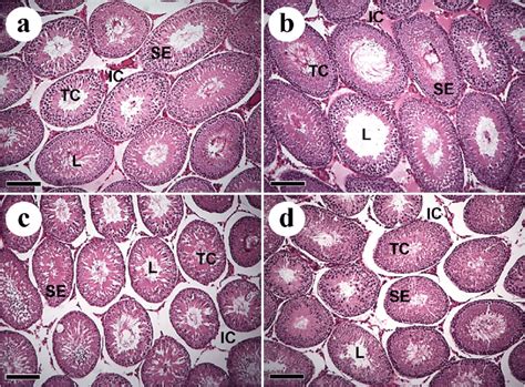 Cross Sections Of The Testicular Parenchyma Of Wistar Rats With Walker