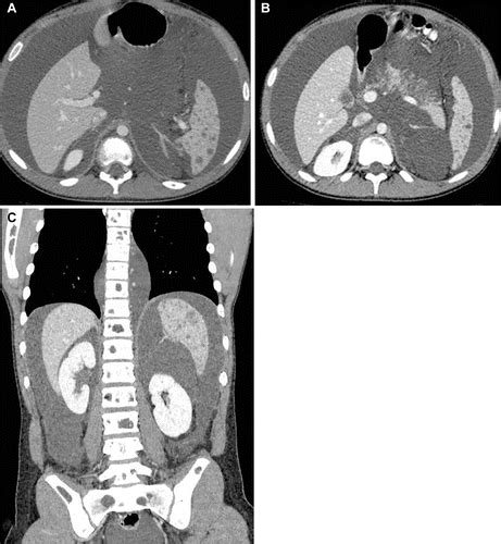 Case Radiology