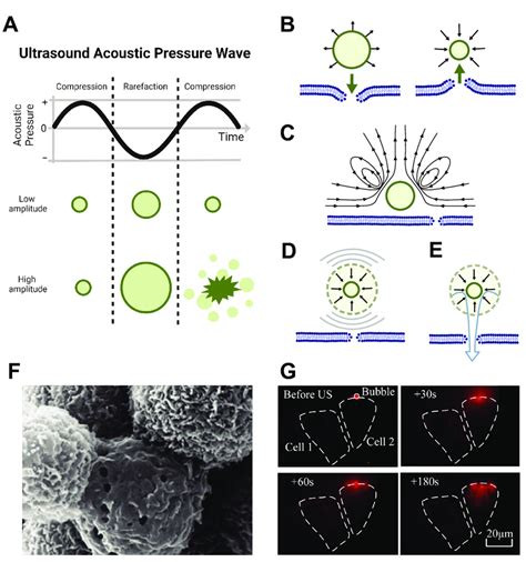 Microbubble Cavitation Induces Sonoporation Of Local Cell Membranes