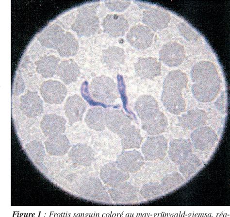 Figure From Trypanosomose Dans Un Effectif De Chiens Militaires En