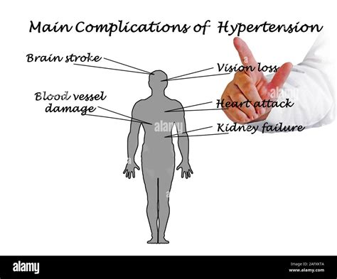 Main Complications Of Hypertension Stock Photo Alamy