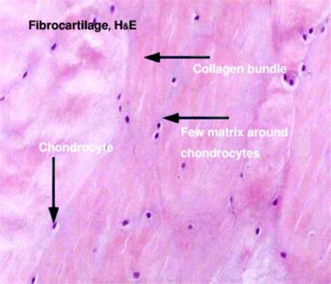 connective tissue cartilage