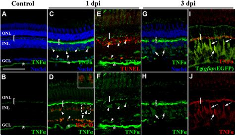 Tnf Expression Increased In Apoptotic Inner Retinal Neurons And Müller