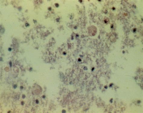 Entamoeba Histolytica Trophozoites In The Wall Of The Colon Identified Download Scientific