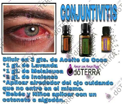 Pin De Niche Gtz En Doterra Mezclas De Aceites Esenciales Recetas De