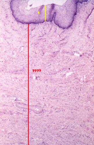 Topic 52 Vagina HE DONT MIX W ESOPHAGUS SLIDE Flashcards Quizlet