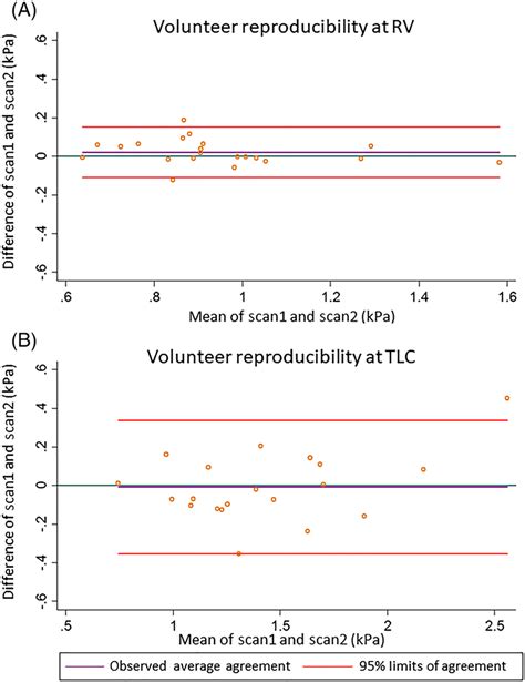Bland Altman S Plots Of Stiffness Reproducibility Measurements At Rv