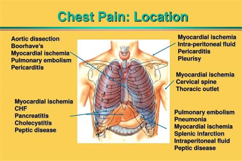 Ppt Evaluation Of Chest Pain In The Emergency Department Powerpoint Presentation Id 2410350