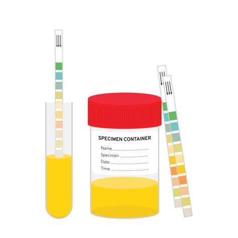 1100 Urine Test Stockillustraties Royalty Free Vector Illustraties