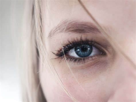 Red Eyes: Why Are My Eyes Red?