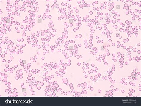 Red Blood Cells Under Microscope Medical Stock Photo 407899246 ...