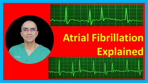 Atrial Fibrillation Explained Youtube