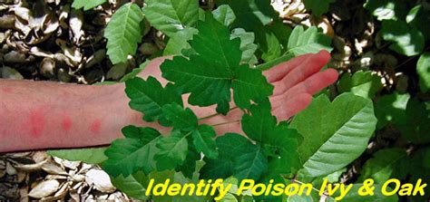 How to Identify Poison Ivy, Oak, and Sumac and Treatments Remedies