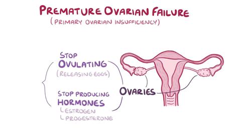 Premature Ovarian Failure Treatment