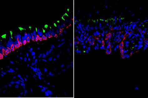 How Airway Cells Work Together In Regeneration And Aging