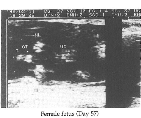 Figure 1 From Ultrasonic Diagnosis Of Bovine Fetal Sex By The Relative