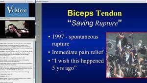 Biceps Tenodesis vs Tenotomy: Do a Tenotomy, I Prefer to Kill The ...