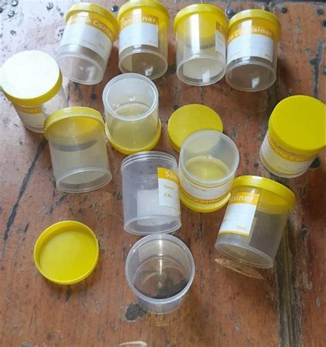 Urine Sample Containers Ml Latest Price Manufacturers Suppliers