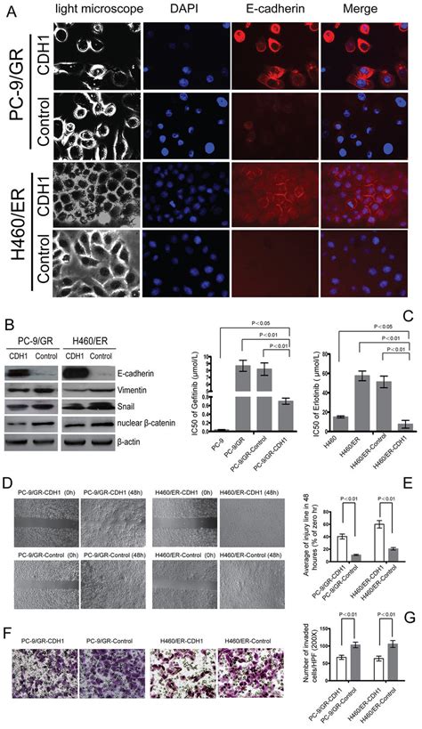 Effect Of E Cadherin Cdh Overexpression On Emt And The Sensitivity