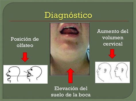 ¿Qué es la Angina de Ludwig? - Clínica Dental en Toledo