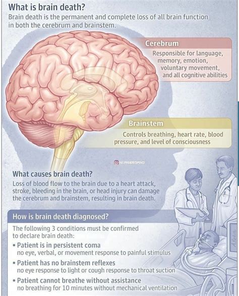 Understanding Stroke Chart 20×26 Artofit