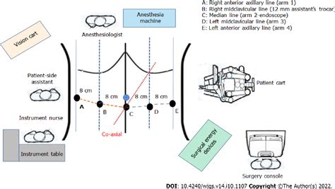 Figure 1 From Performing Robot Assisted Pylorus And Vagus Nerve Preserving Gastrectomy For Early