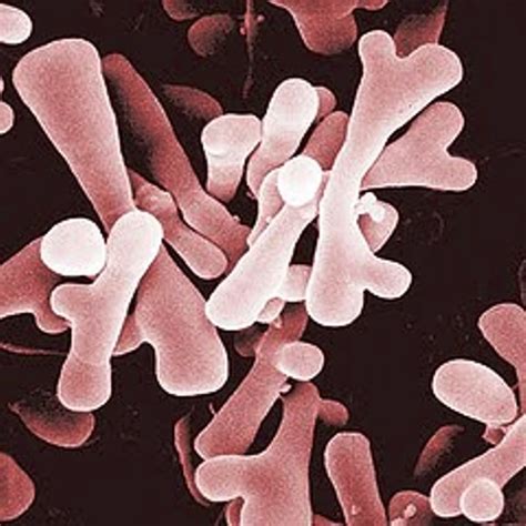 The Data Of Microbiology Bifidobacterium Dentium Gram Positive