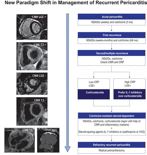 Pericardial Disease Outcomes Cleveland Clinic