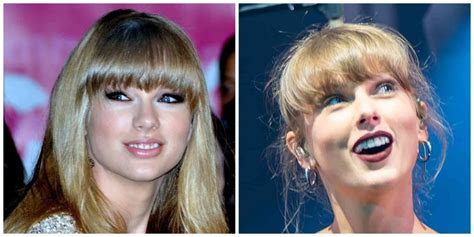 Taylor Swift's Teeth: Are They Real? | Longevita