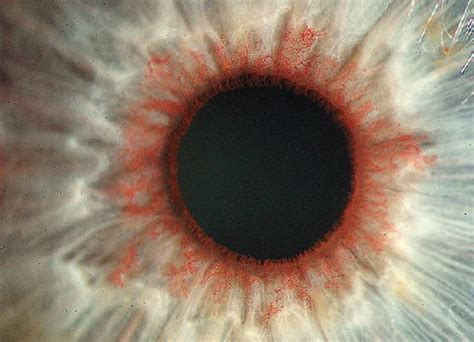 1000+ images about Pupils on Pinterest | Medicine, The two and Eyes