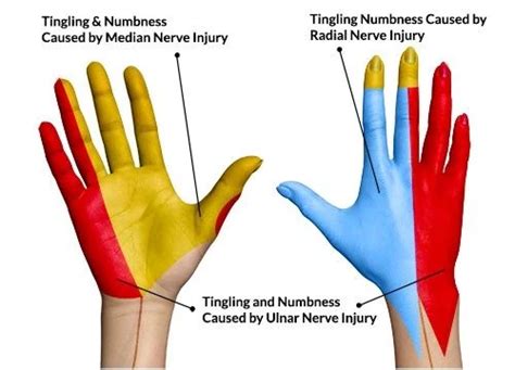 Having Finger Numbness: Left Hand or Right Hand