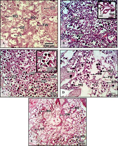 Photomicrographs Of The Results Of Female Paphia Textile S Gonadal