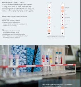 Galileo Echo Lumena Immucor Blood Bank Analyzer Automated Skrooll