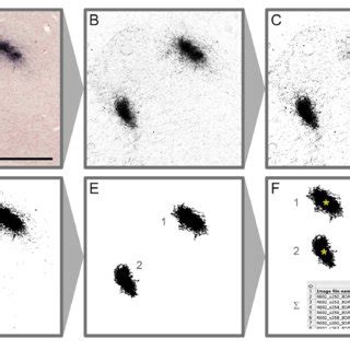 Pdf Brain Wide Mapping Of Axonal Connections Workflow For Automated