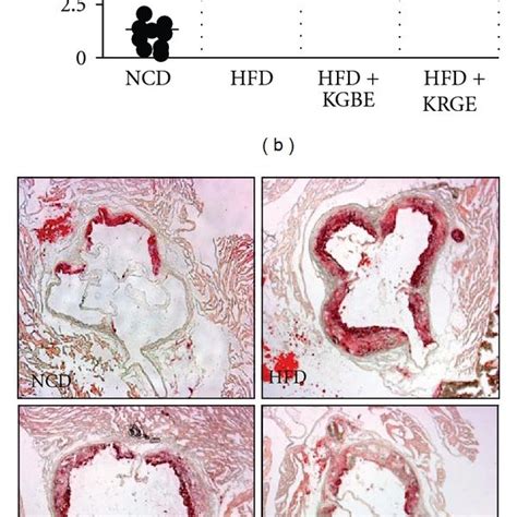 Kgbe Reduces Atherosclerotic Lesion Formation In Apoe Mice Fed A Hfd