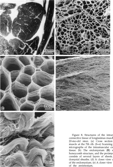 Figure 1 From Structural Changes In Intramuscular Connective Tissue