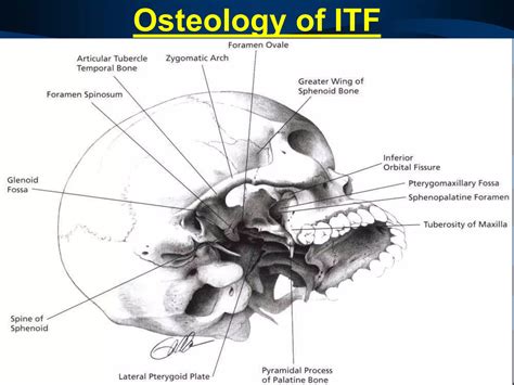 Surgical Anatomy Of Infratemporal Fossa By Dr Aditya Tiwari Ppt