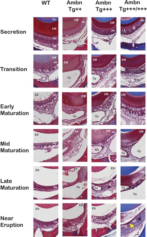 Frontiers Overexpression Of Ameloblastin In Secretory Ameloblasts