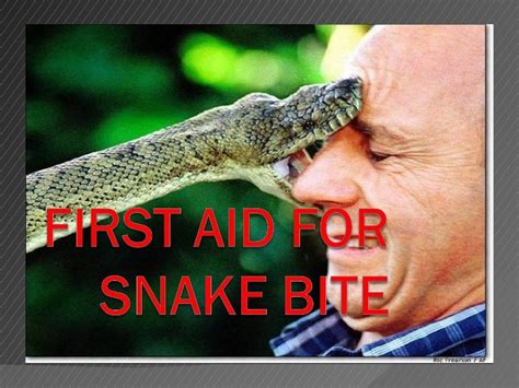 First Aid For Snake Bite