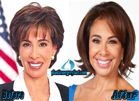 Jeanine Pirro Plastic Surgery Before and After Pictures