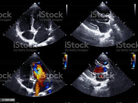 Download Free 100 + echocardiography wallpaper