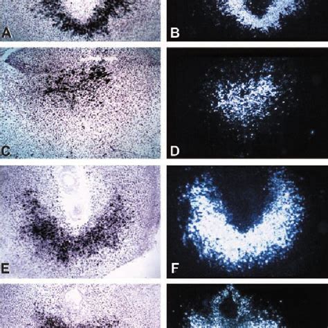 Localization Of PLP J MRNA In Rat And Mouse Decidual Tissues The In