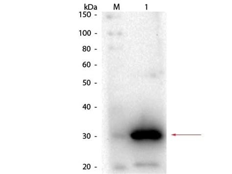 Carbonic Anhydrase I Ca Antibody Nb Novus Biologicals