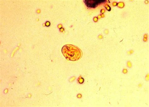 Cyst Wet Mount Iodine Stain Department Of Parasitology Faculty Of Medicine Chiangmai University