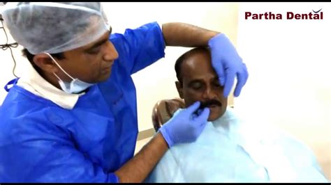 Implant For Missing Tooth Latest Technology In Partha Dental II