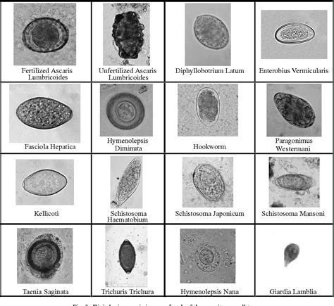 Human Parasite Egg Identification Chart