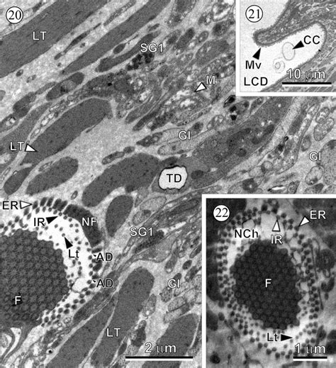 Ultrastructure of the protonephridial system. Figs 20 and 22 ...