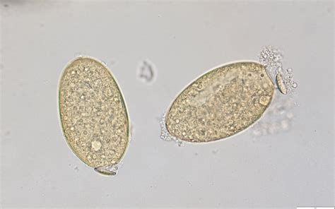 Fasciola Hepatica Egg Morphology