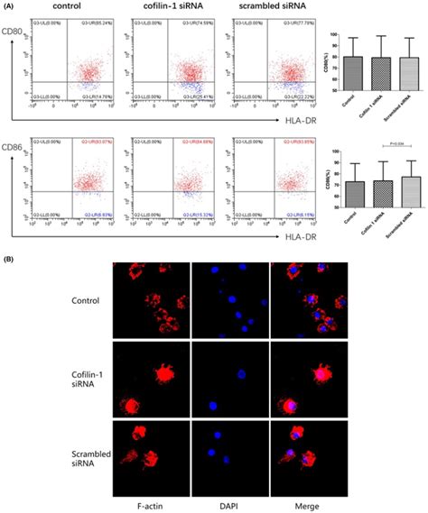 Expression Of CD80 CD86 And Factin In MDCs From Patients With SAA