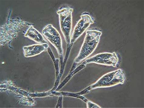 水のはなし（下水道編その6） 反応タンクの微生物 旭川市